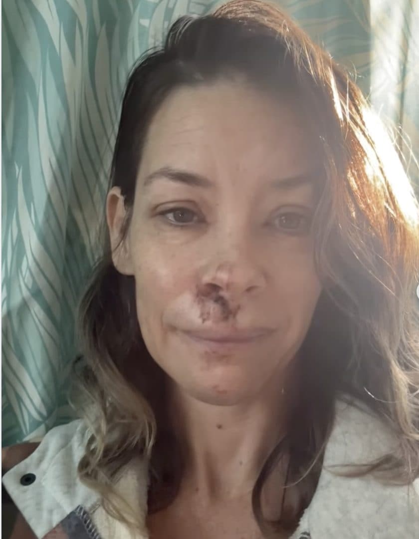 Foto scattata dopo l’incidente, nel 2025