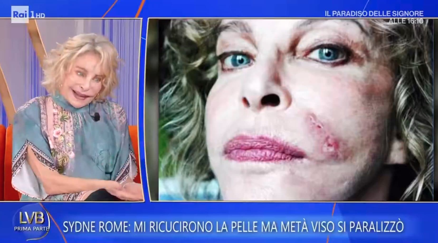 Sydne Rome: "Dopo l'incidente il viso era paralizzato, ho aspettato 16 anni per riavere la mia faccia"