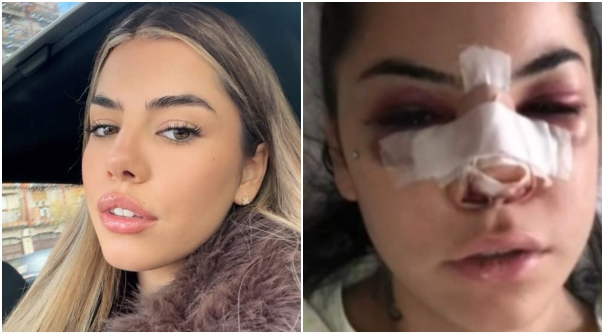 Chiara Balistreri, ridotta la pena al suo ex che la mandò in ospedale: "Questo paese mi fa schifo"