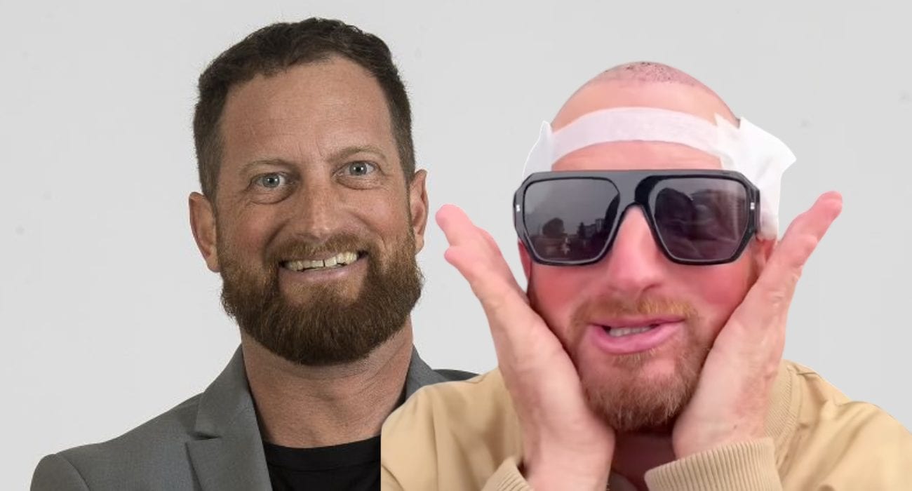 Mattia Fumagalli si sottopone al trapianto di capelli dopo il GF: "Ho vissuto per anni con il cappellino"