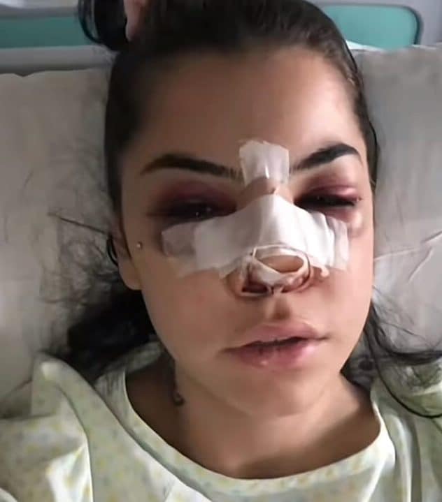 Chiara Balistreri mostra sui social il suo volto tumefatto