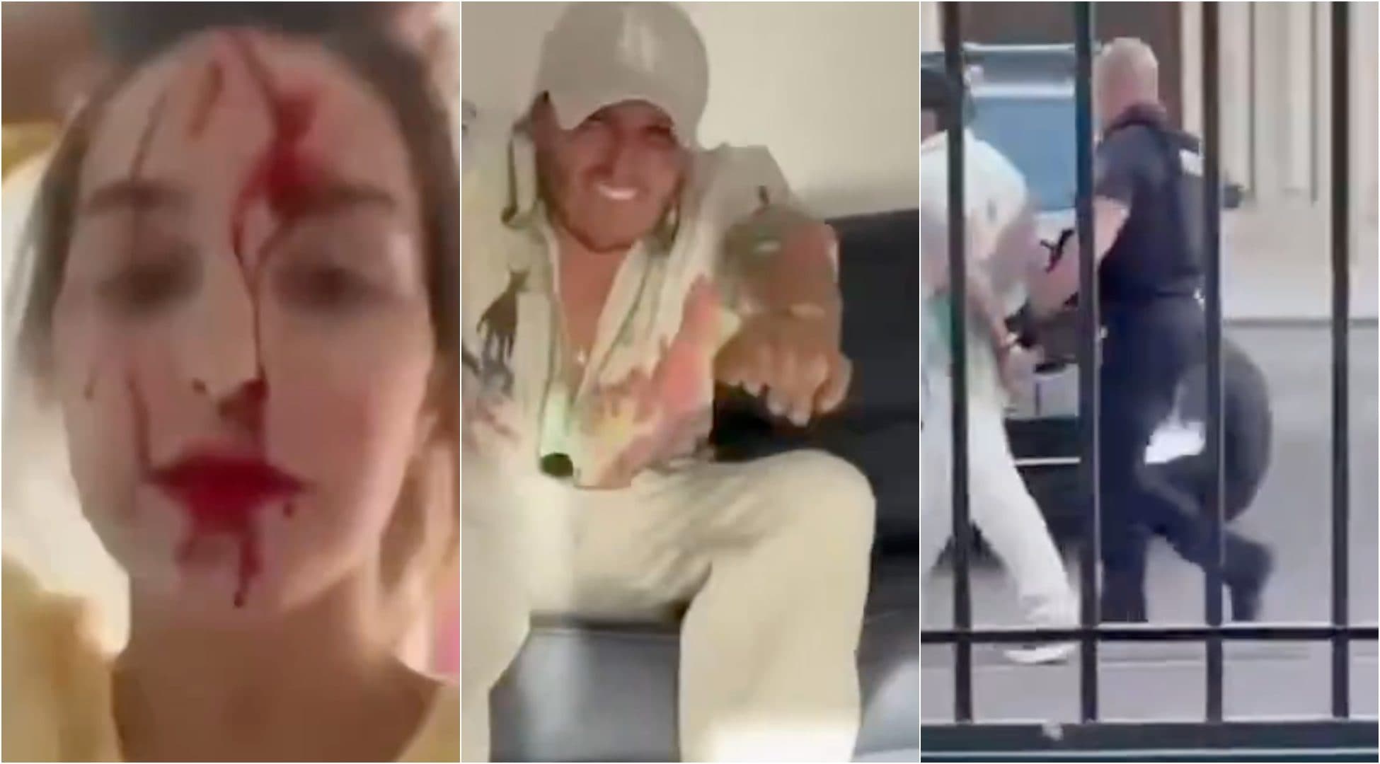 Miss Venezuela aggredita dallo stilista Giovanni Laguna: arrestato dopo il video pubblicato con il volto insanguinato