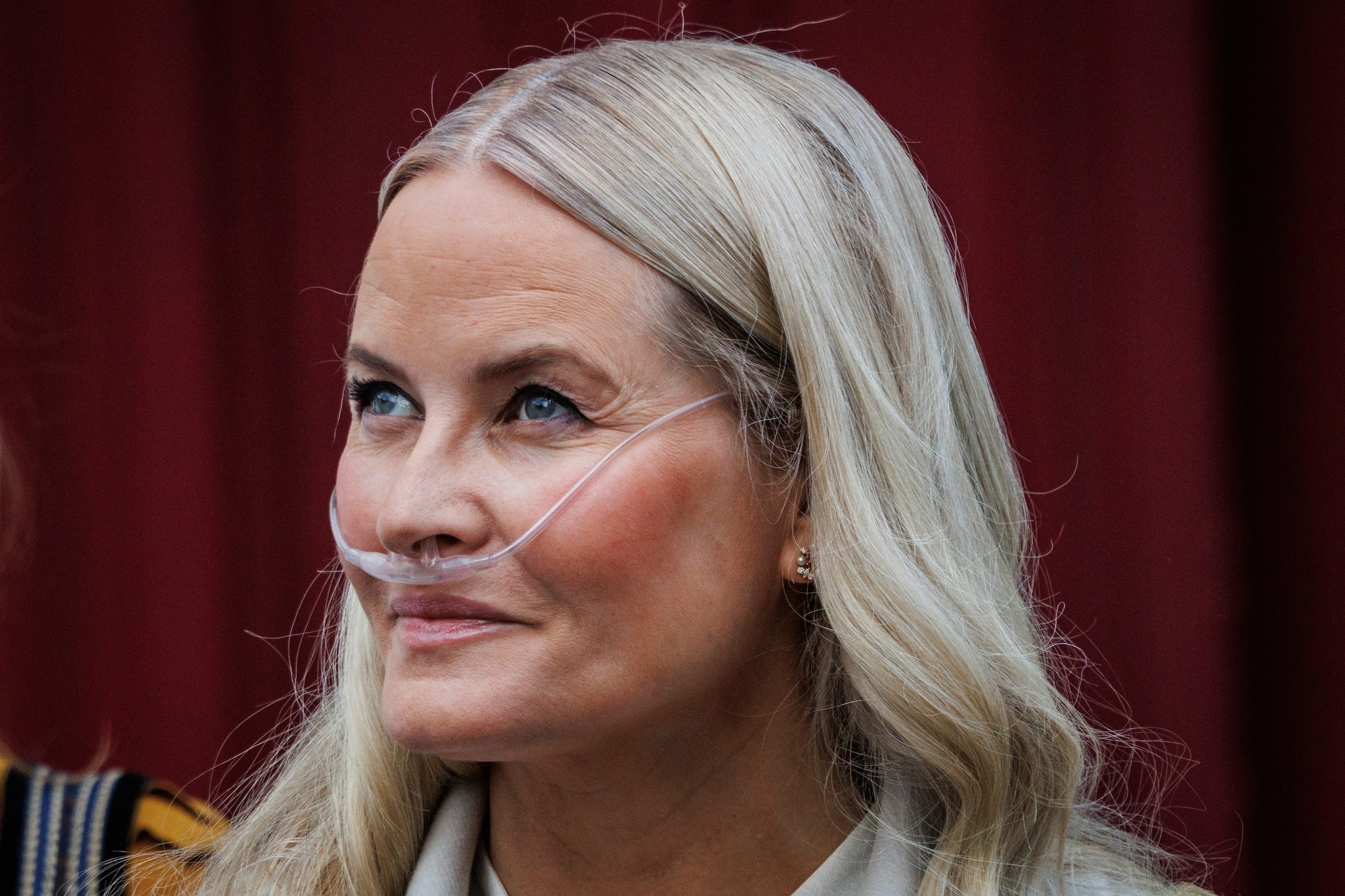 La principessa Mette-Marit sottoposta a trapianto di polmone: "L'intervento è riuscito"