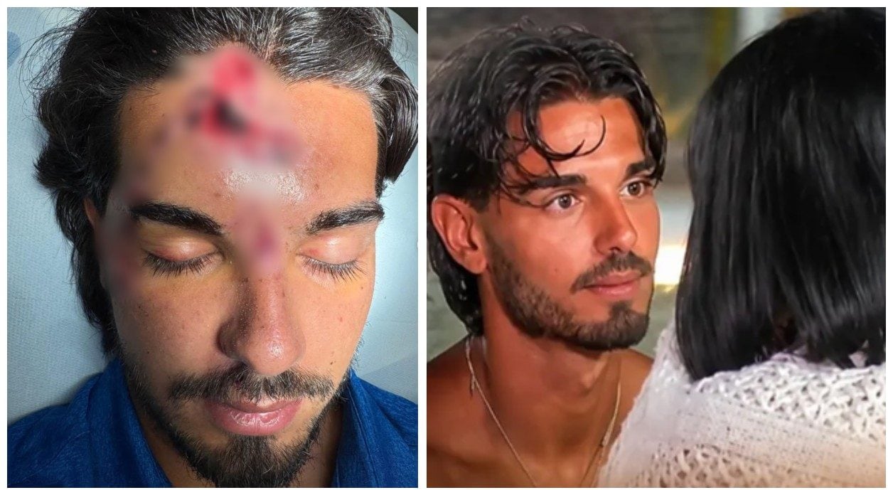 Incidente per Marco Fatata, il single vicino a Francesca a Temptation Island: "Mi è passata la vita davanti"