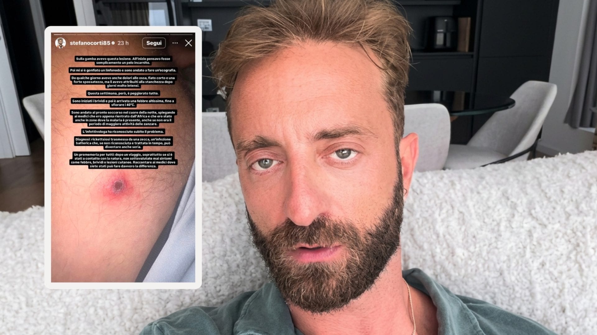 Stefano Corti morso da una zecca: "Ricoverato in ospedale dopo febbre altissima, dolore alle ossa e nausea"