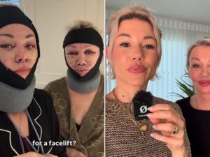Madre e figlia in Corea del Sud per sottoporsi insieme a un intervento di lifting