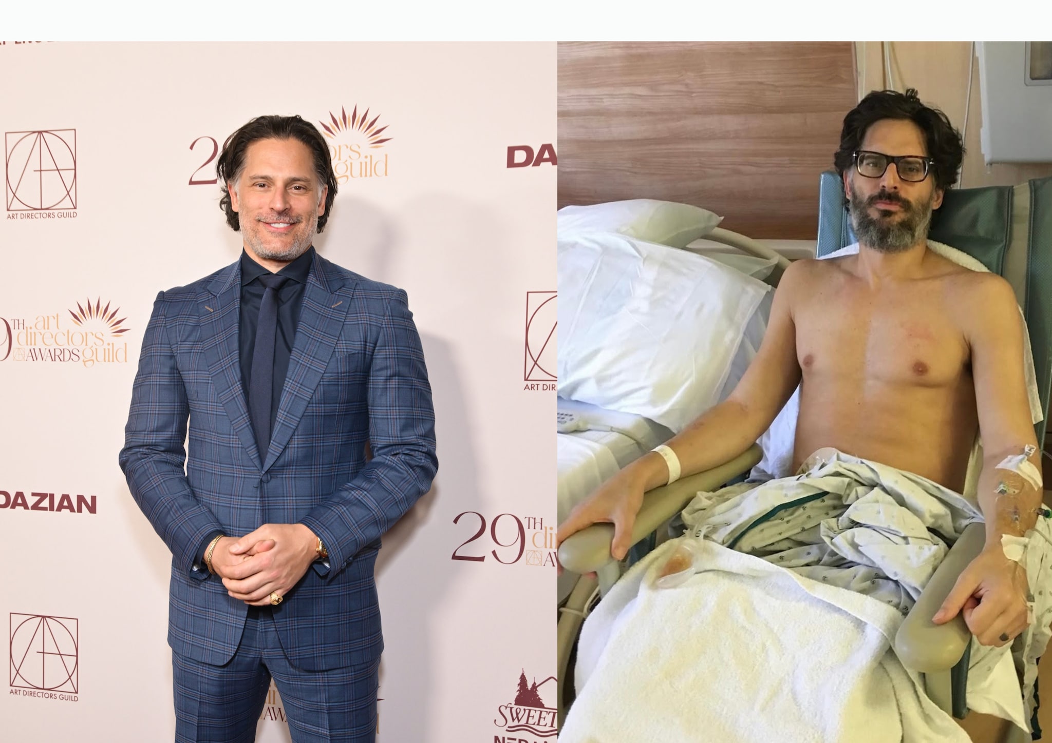 Joe Manganiello pubblica le foto in ospedale e racconta la sua misteriosa malattia: “Persi 27 chili in due settimane”