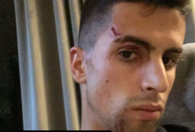 La foto condivisa sui social da Joao Cancelo dopo la rapina subita in casa