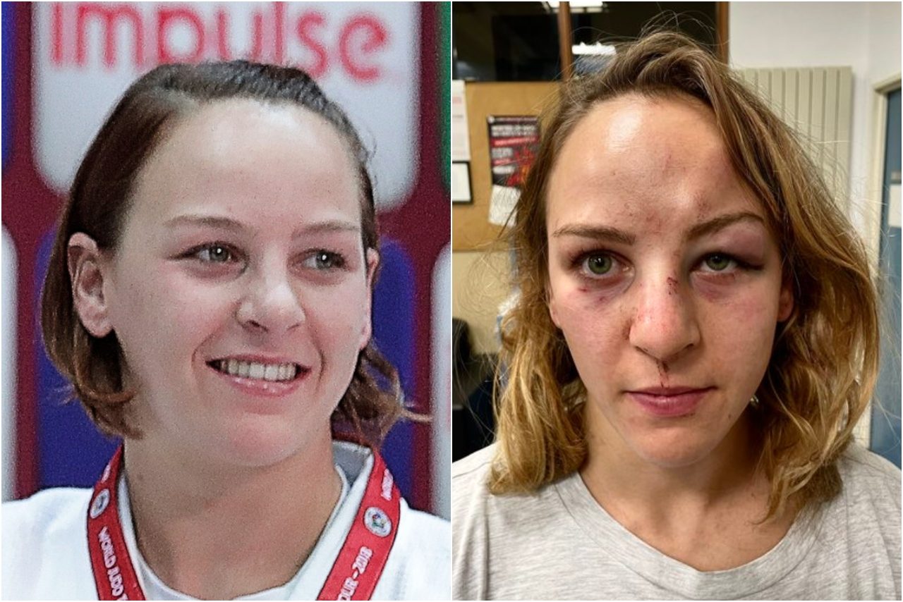 La judoka olimpionica, Margaux Pinot, ha pubblicato la foto che mostra i segni della violenza subita