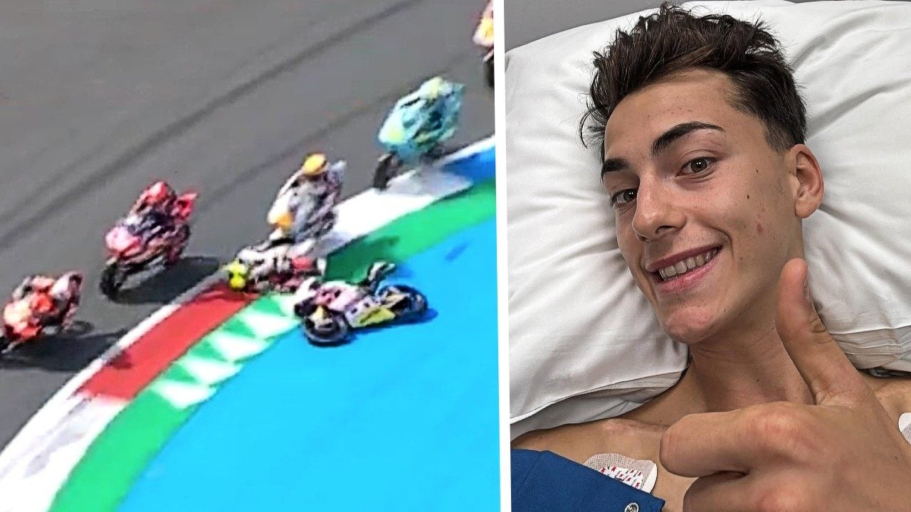 Luca Lunetta dopo il tremendo incidente ad Assen: "Frattura pluriframmentaria, sono fortunato"