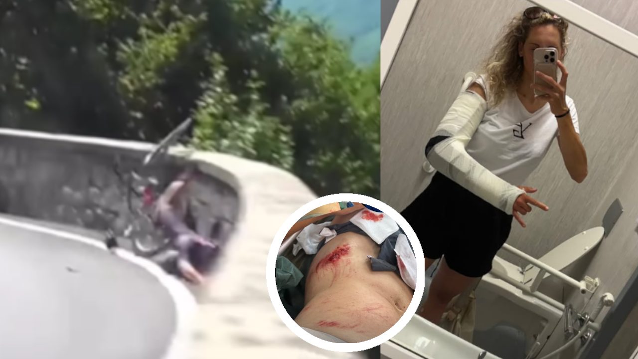 Le terribili conseguenze della caduta sul corpo di Vittoria Guazzini: "Sono stata fortunata"