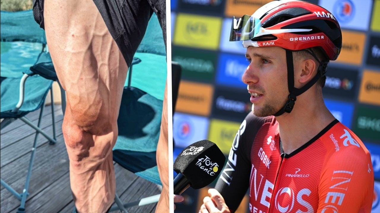 Laurance mostra gli effetti del Tour de France sulle gambe dei ciclisti: perché si riducono così