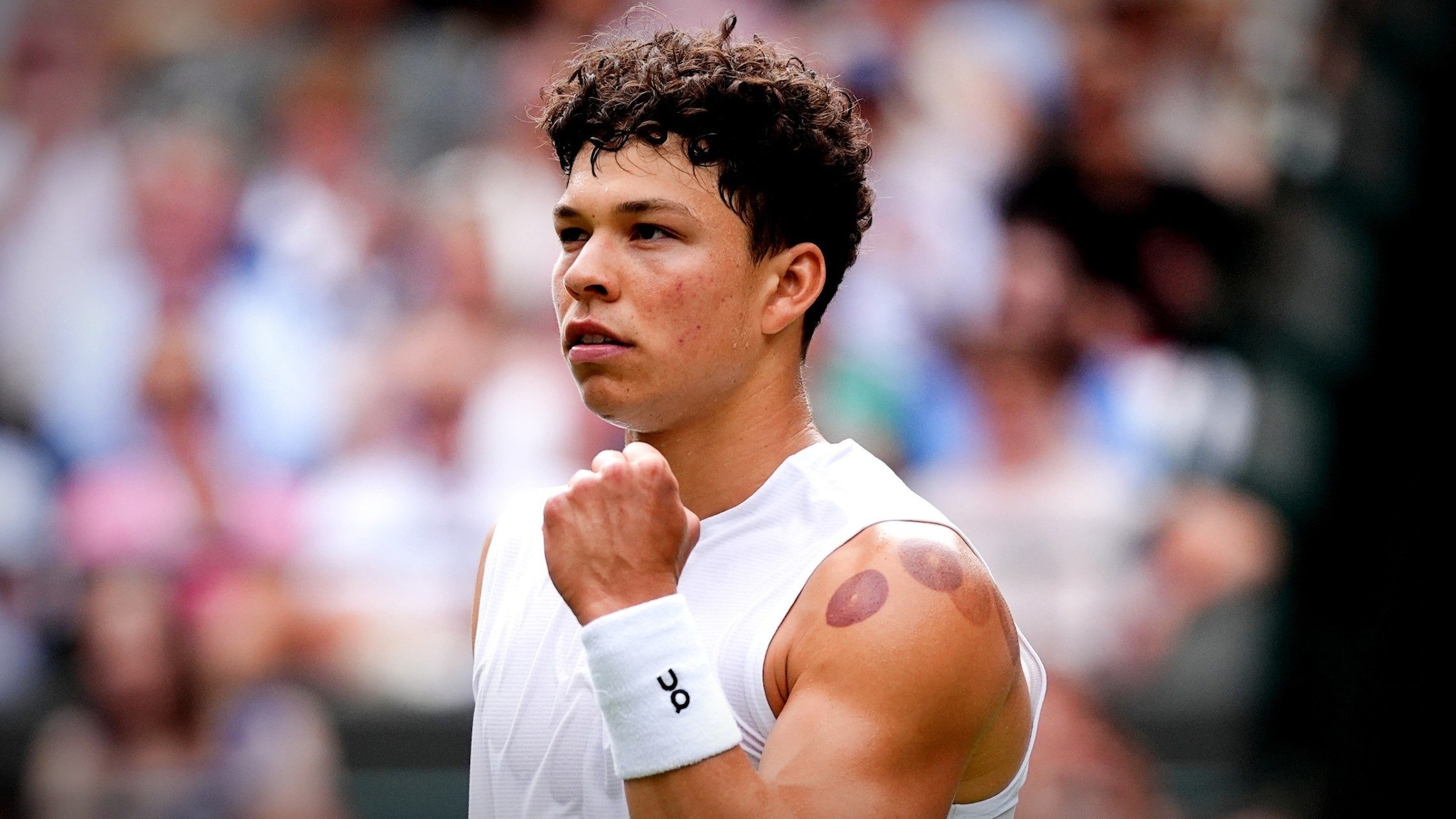 Shelton mostra i segni scuri della coppettazione sulle spalle a Wimbledon: a cosa serve