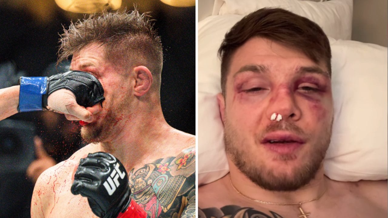 Marvin Vettori: "Ho lottato 3 round col naso distrutto da un solo pugno. Non mi era mai successo"