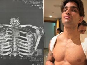 jorge-martin-operato-alla-clavicola-300x225.jpg