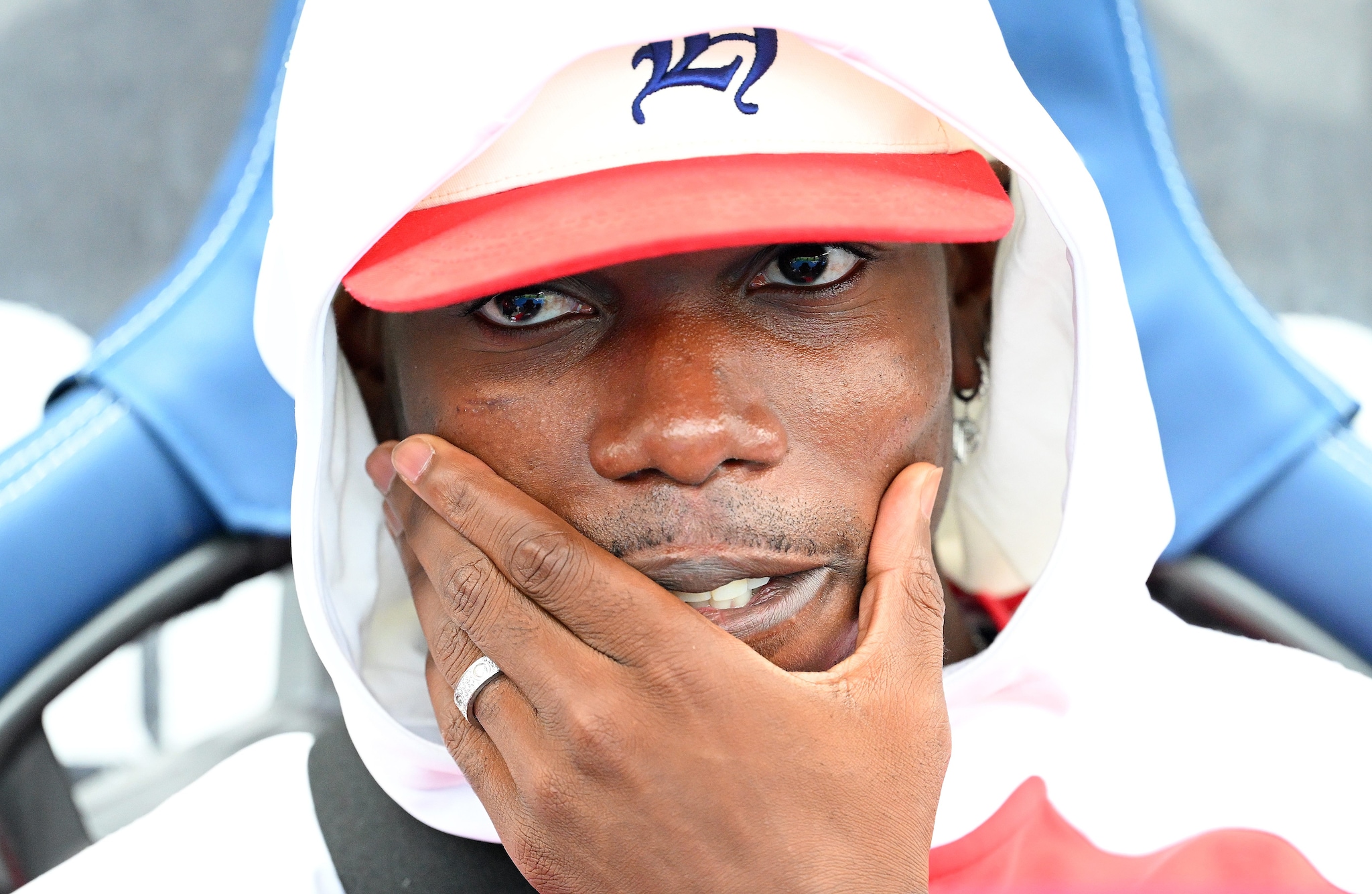 Paul Pogba di nuovo fermo ai box, il "Pogback" è rimandato a tempo indeterminato: cos'è successo