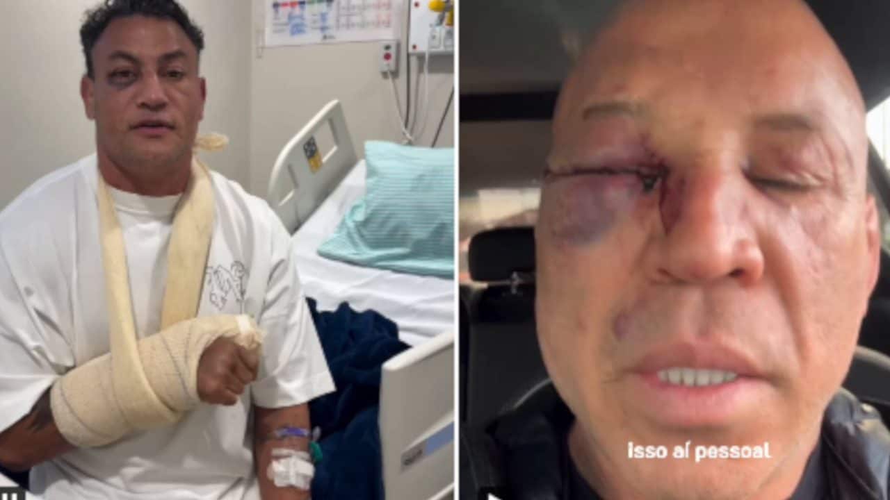 Le conseguenze della rissa su Freitas e Silva a margine dell’evento–esibizione