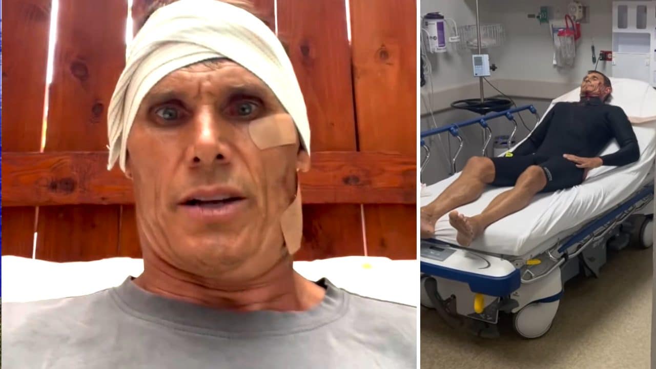 Il pauroso incidente di surf di Jamie Mitchell, 18 punti di sutura al collo e 15 in gola: "Ma sto bene"