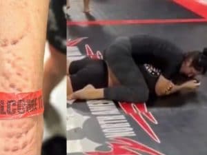 Ana Bozovic presa a morsi bestiali: orribile episodio durante un combattimento di Jiu-Jitsu