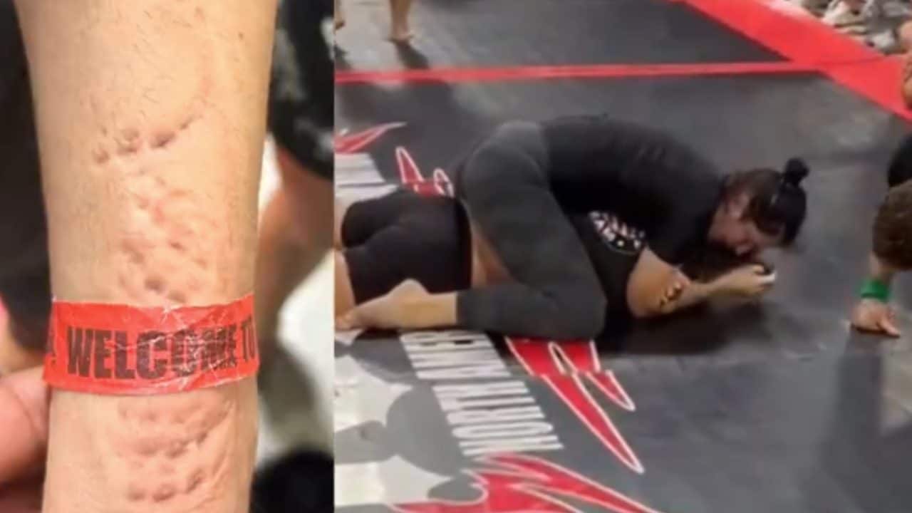 Ana Bozovic presa a morsi bestiali: orribile episodio durante un combattimento di Jiu-Jitsu