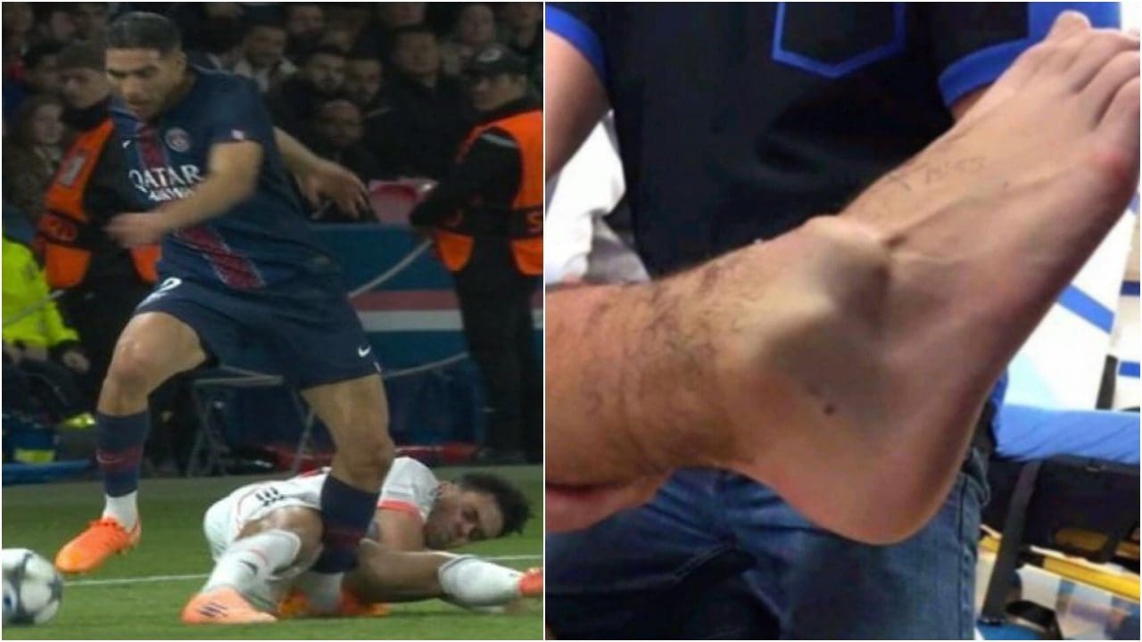 Le condizioni della caviglia di Hakimi dopo l'infortunio in PSG-Bayern Monaco: è impressionante