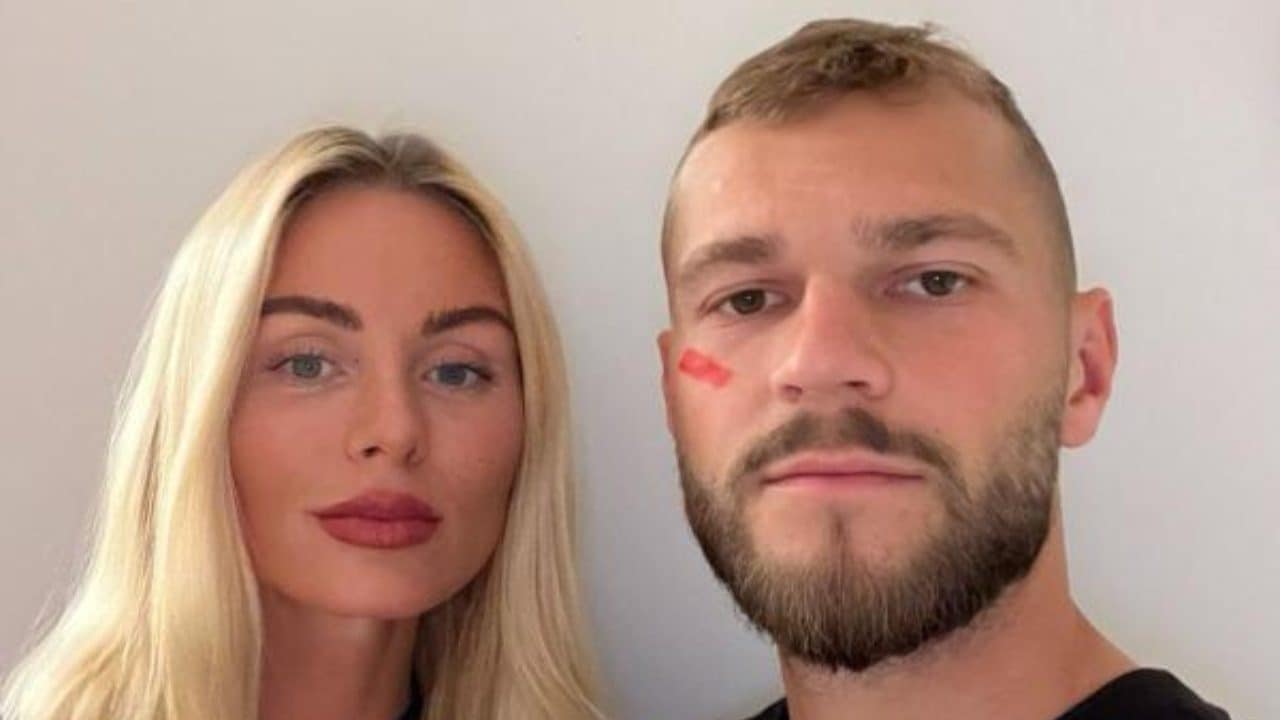 Perché i calciatori hanno un segno rosso in faccia nelle partite di oggi per la 12ª partita di Serie A