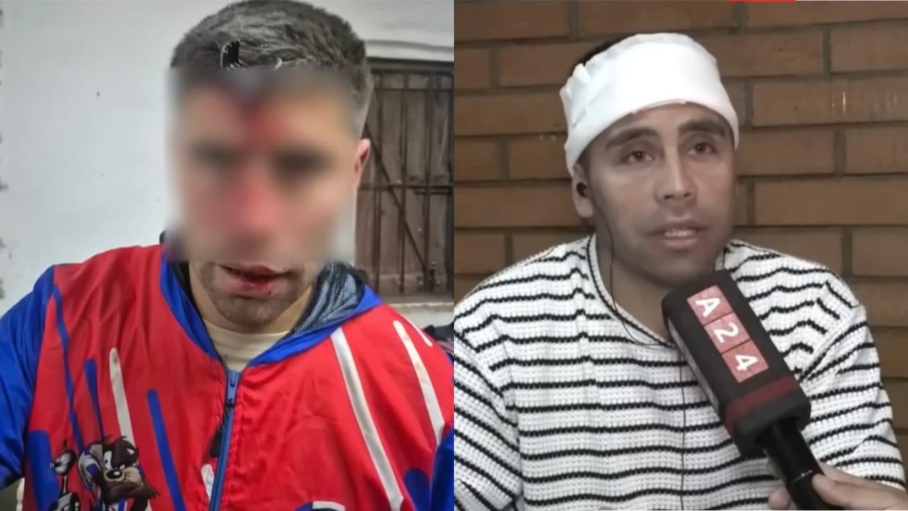 Conficcano una chiave d'auto in testa al padre di una giovane calciatrice: orrore in Argentina