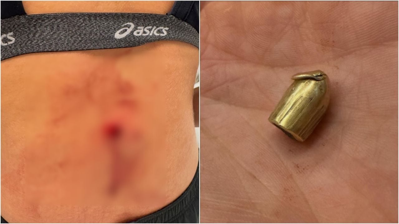 Il bossolo del proiettile che ha colpito la giocatrice alla schiena.