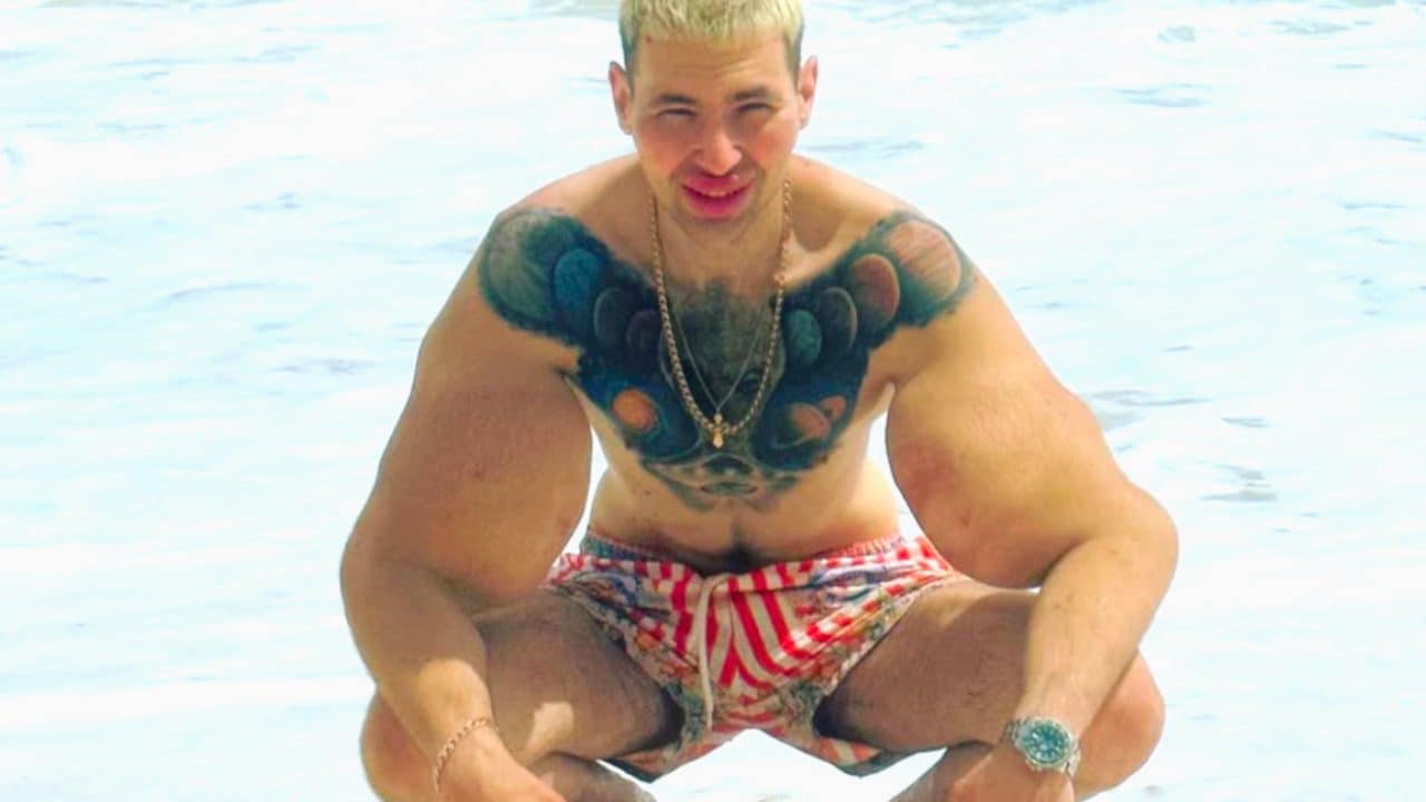 Il Braccio di Ferro russo rischia di perdere le braccia: ha iniettato vaselina e synthol nei bicipiti