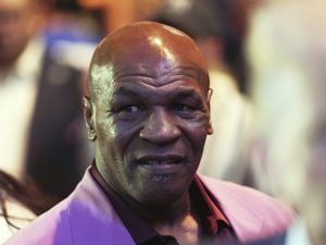 Mike Tyson e la malattia ai piedi: &#8220;Sembra che le dita siano esplose. Nessuna crema può aiutarmi&#8221;