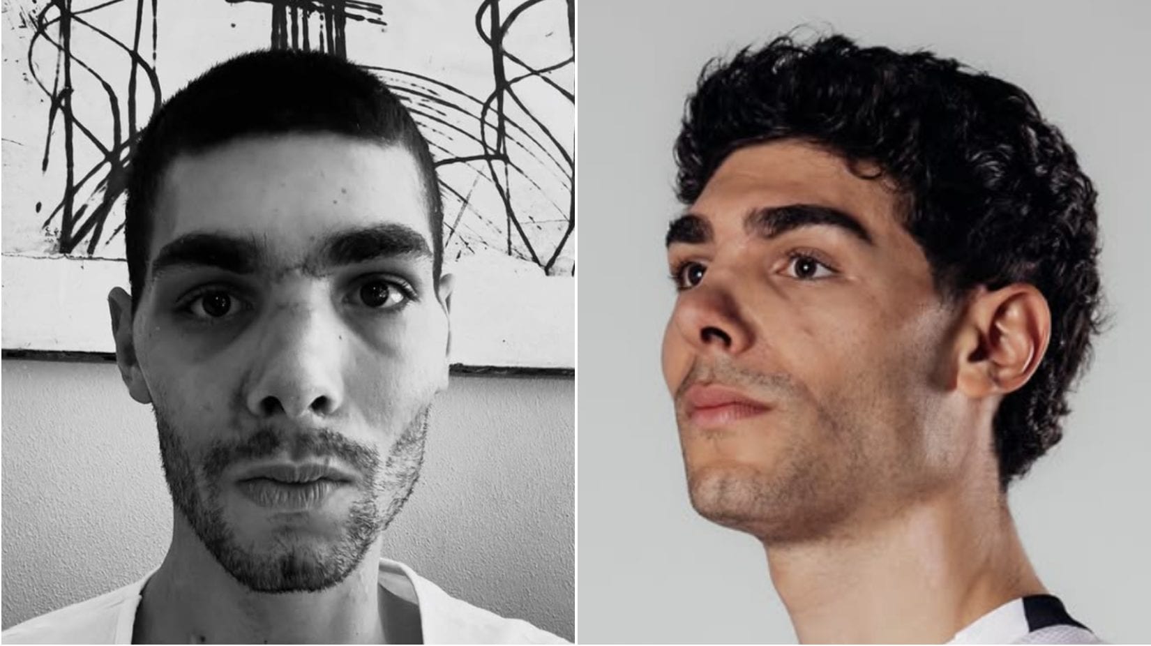 Filippo Baroncini: "Un miracolo essere vivo. C'è qualcosa che ancora mi tormenta dopo la caduta"