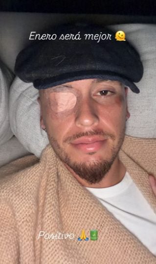 L’immagine pubblicata da Ocampos dopo la diagnosi di paralisi facciale