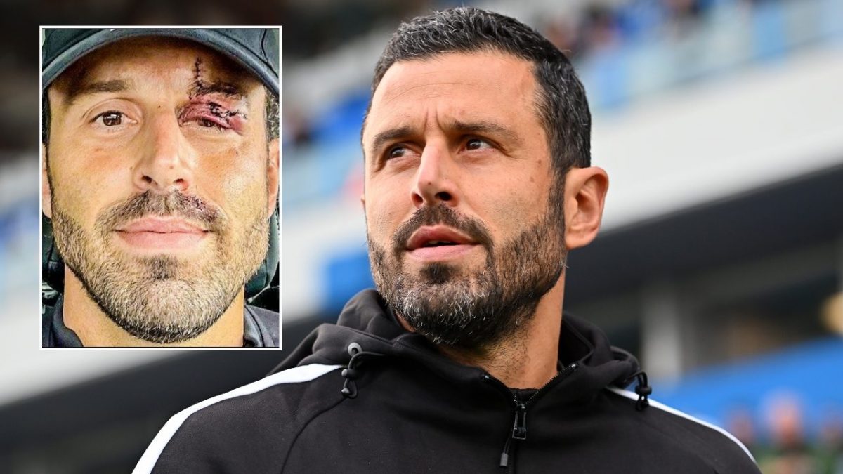 Fabio Grosso oggi è l’allenatore del Sassuolo in Serie A.