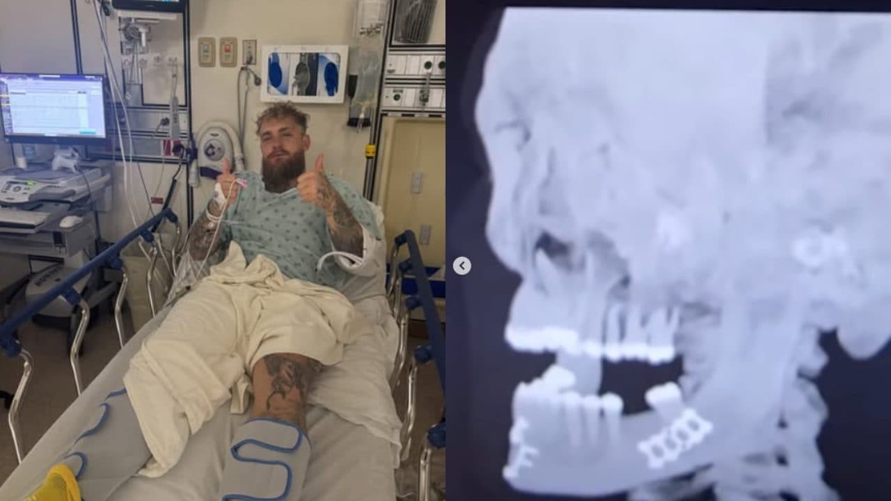 Jake Paul ko contro Joshua mostra la sua mascella dopo l'operazione: "Dovrò assumere solo liquidi"