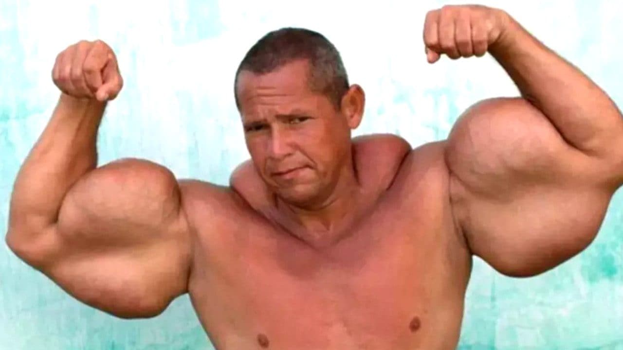 Il bodybuilder Arlindo "Anomaly" de Sousa stroncato dal Synthol a soli 55 anni: aveva bicipiti da 73cm