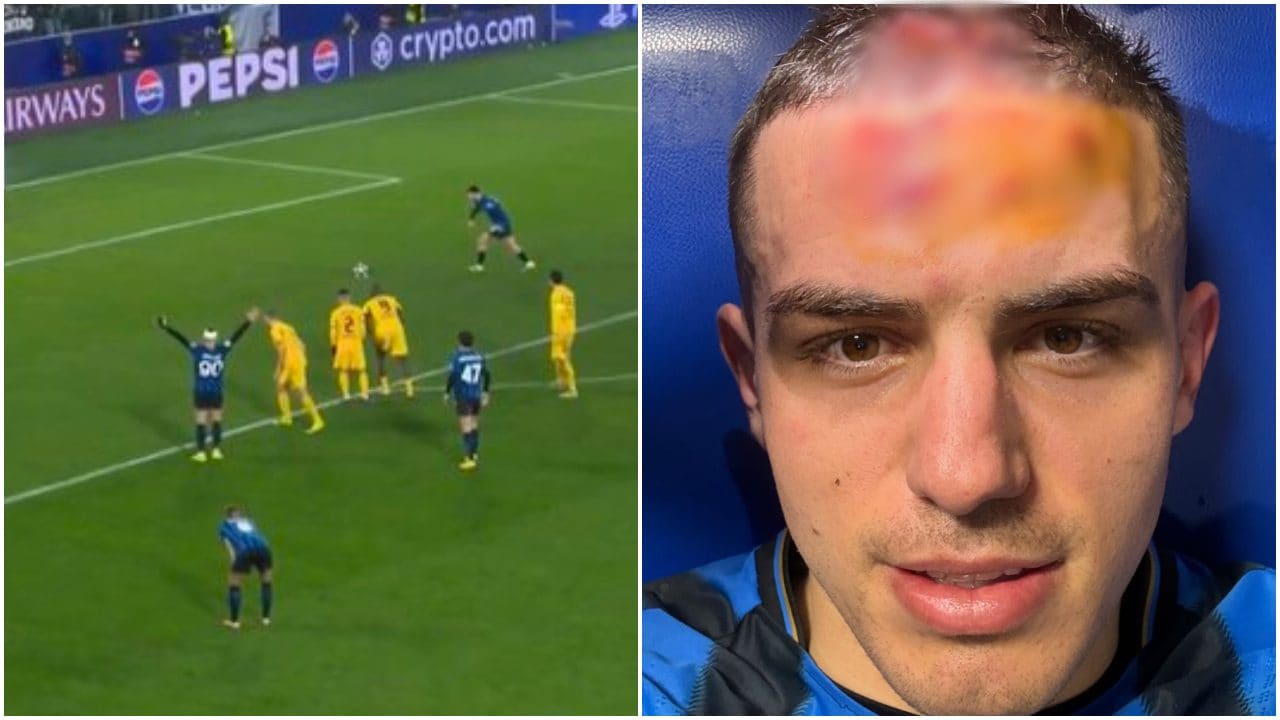 Krstovic esulta prima del rigore di Samardzic, poi si ritrova col volto deturpato in spogliatoio