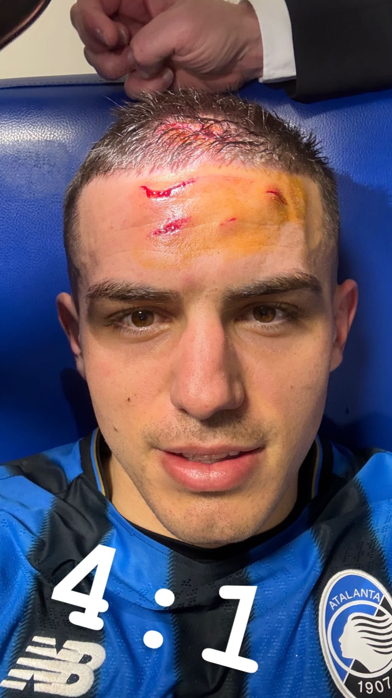 La foto pubblicata su Instagram dopo la partita da Krstovic