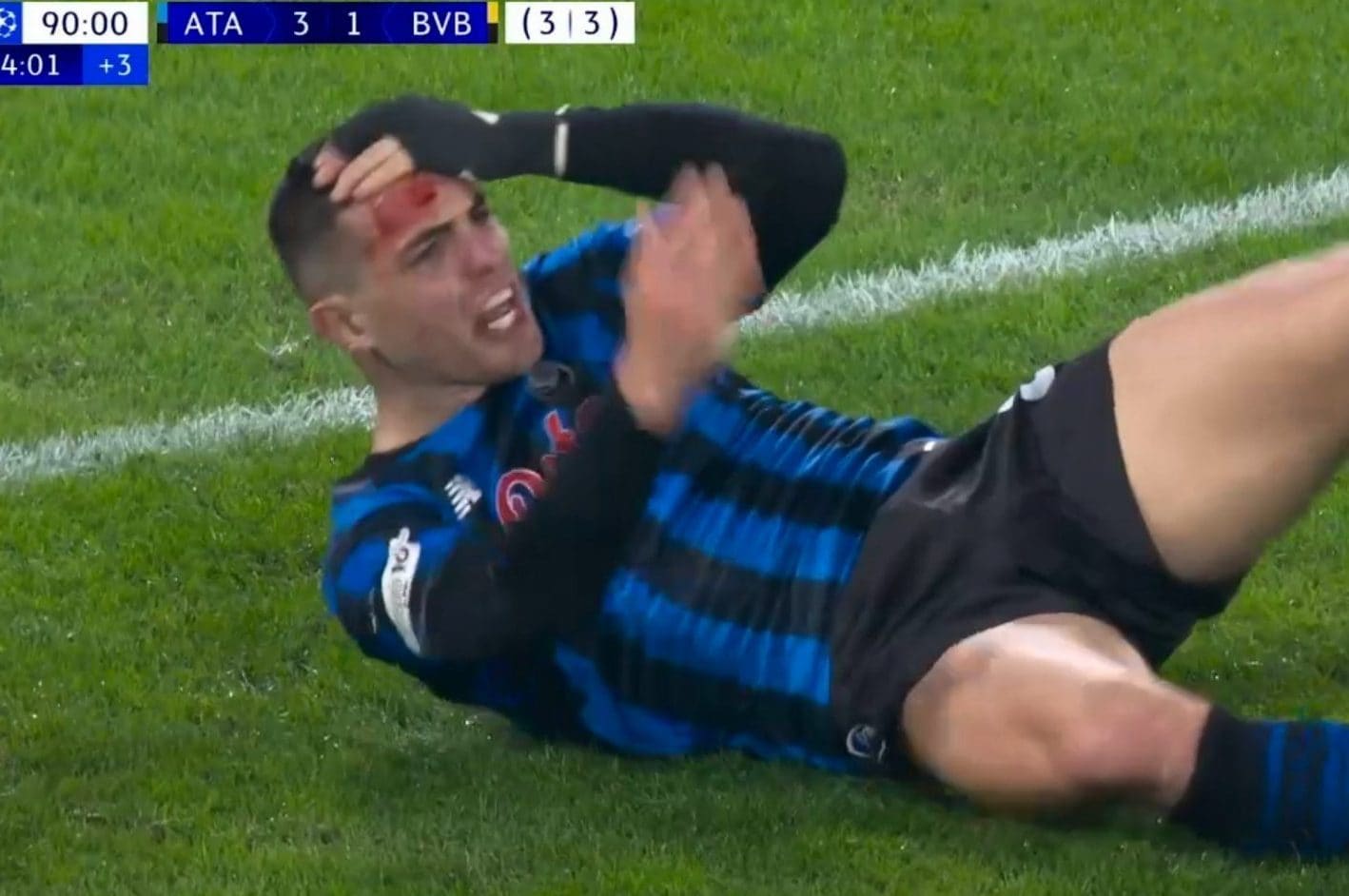 Nikola Krstovic sanguinante dopo essere stato colpito in testa dal tacco di Bensebaini