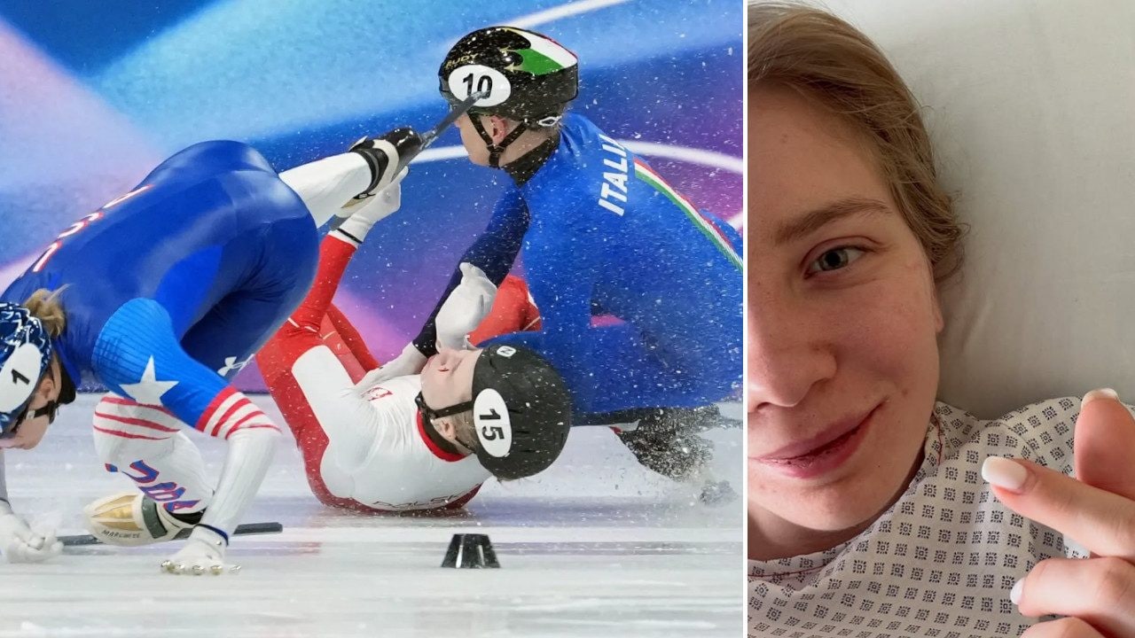 Come sta Kamila Sellier operata dopo il taglio della lama al volto: mostra solo l'occhio sano