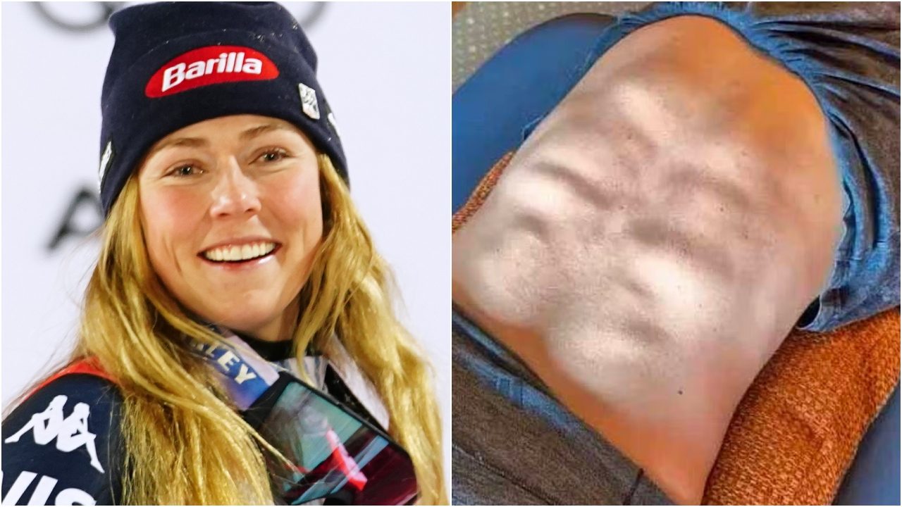 Mikaela Shiffrin mostra l'impressionante "tartaruga" di muscoli sulla schiena: a cosa serve