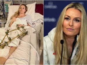 “Lindsey Vonn impiegherà mesi solo per tornare a camminare”: l’esperto spiega cosa le succederà
