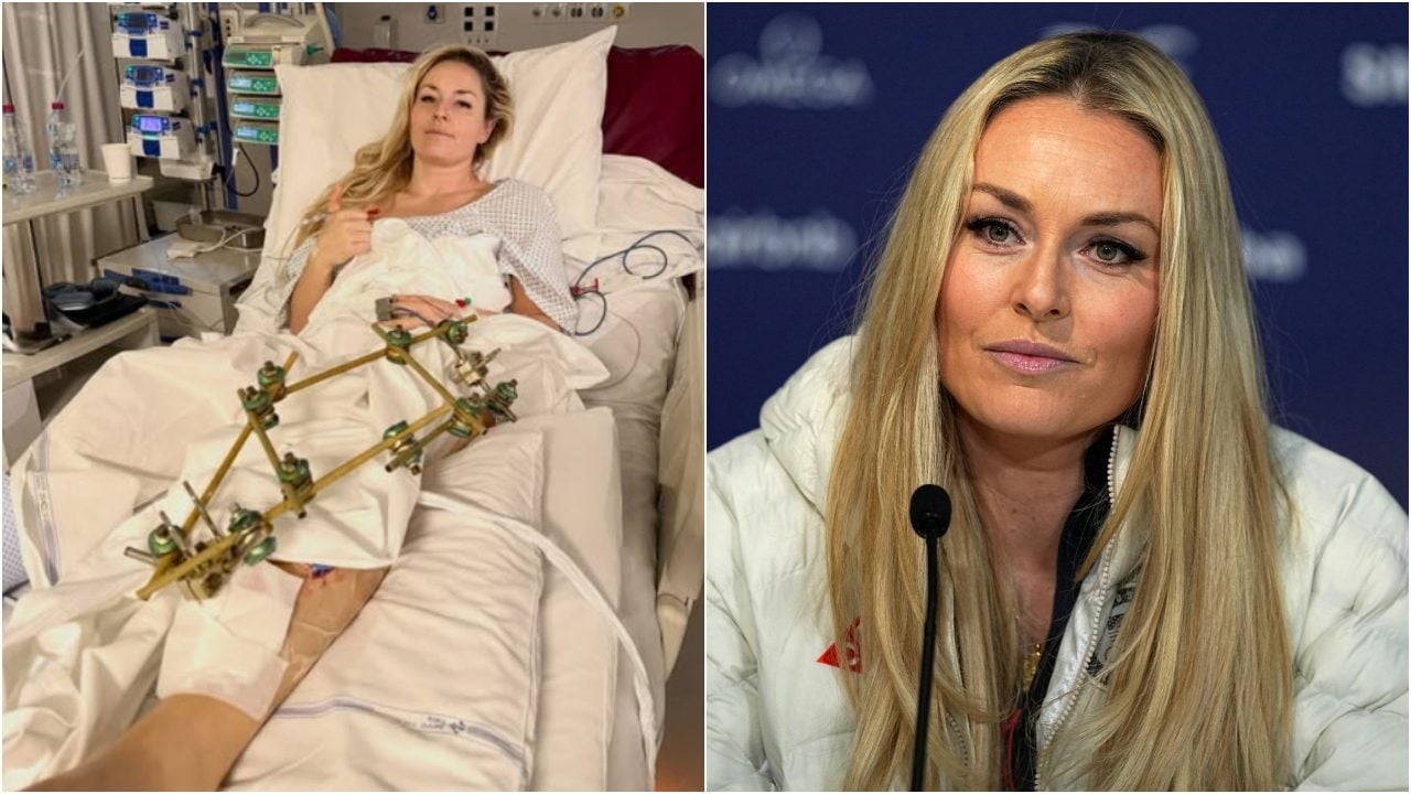"Lindsey Vonn impiegherà mesi solo per tornare a camminare": l'esperto spiega cosa le succederà