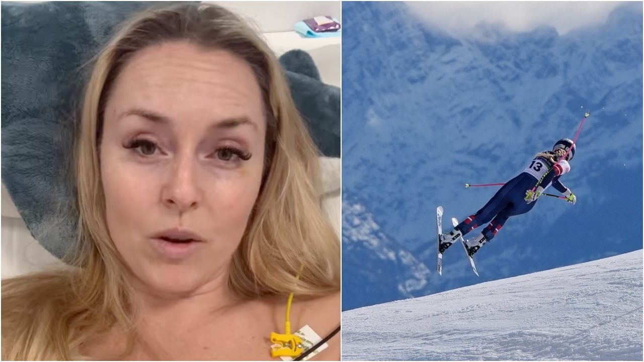 Lindsey Vonn mostra la sua sofferenza in un video e annuncia: "Mi opero per la quarta volta"