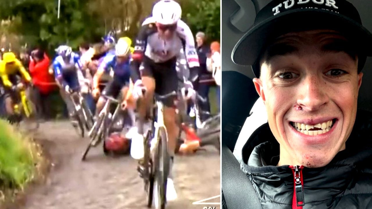 Come sta Rick Pluimers dopo essersi spezzato i canini cadendo sul pavè: "Ho ritrovato i miei denti"