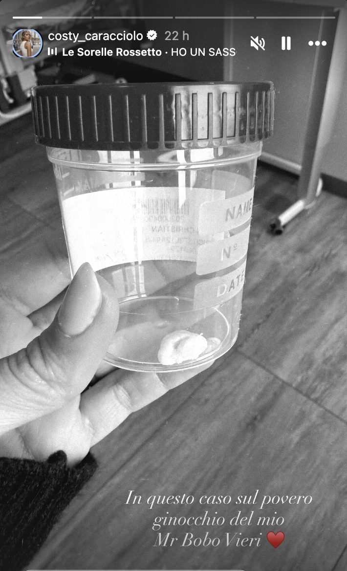 Costanza Caracciolo mostra il frammento di osso rimosso dal ginocchio di Vieri