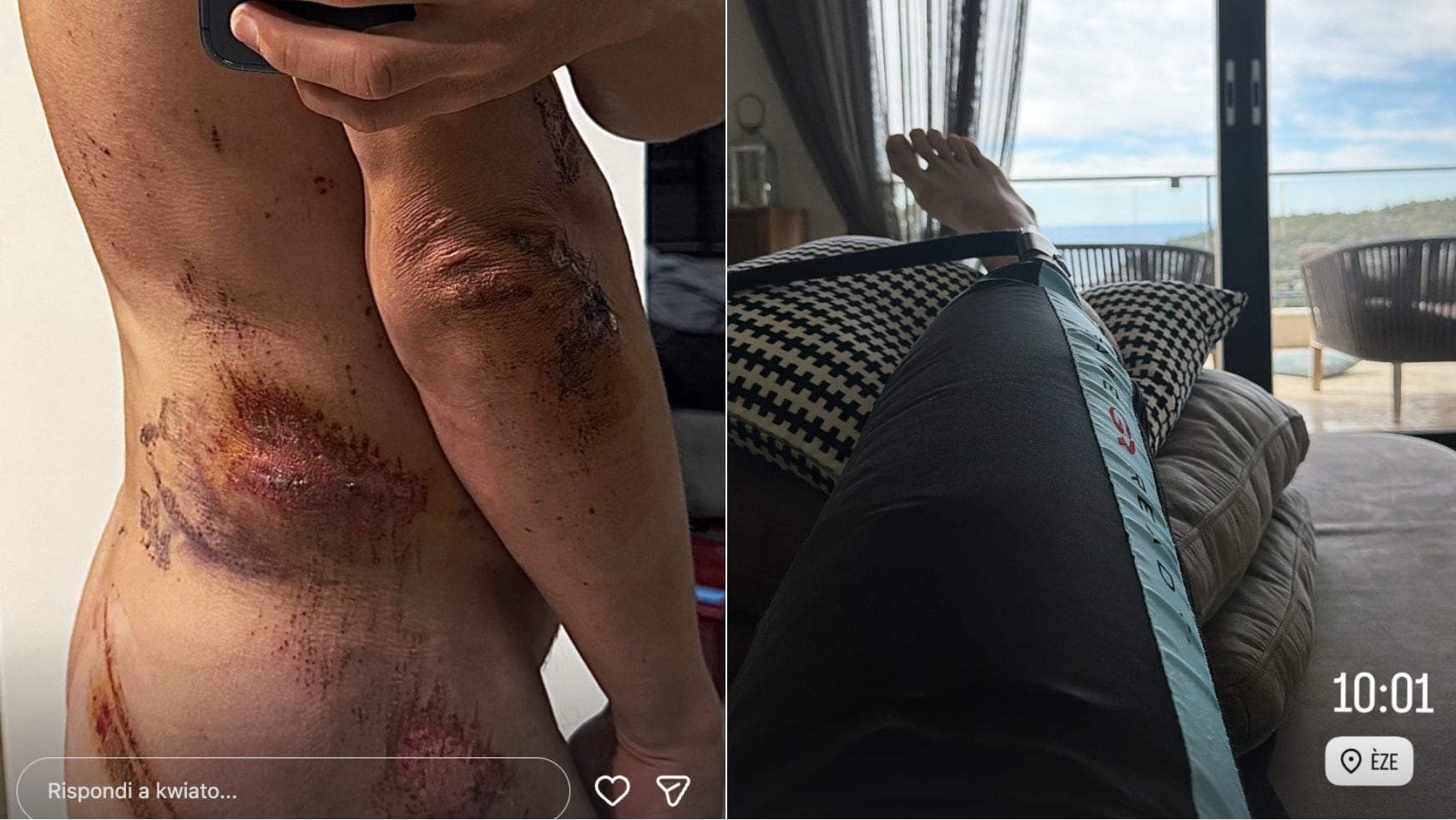 Le foto postate sui social da Michal Kwiatkowski