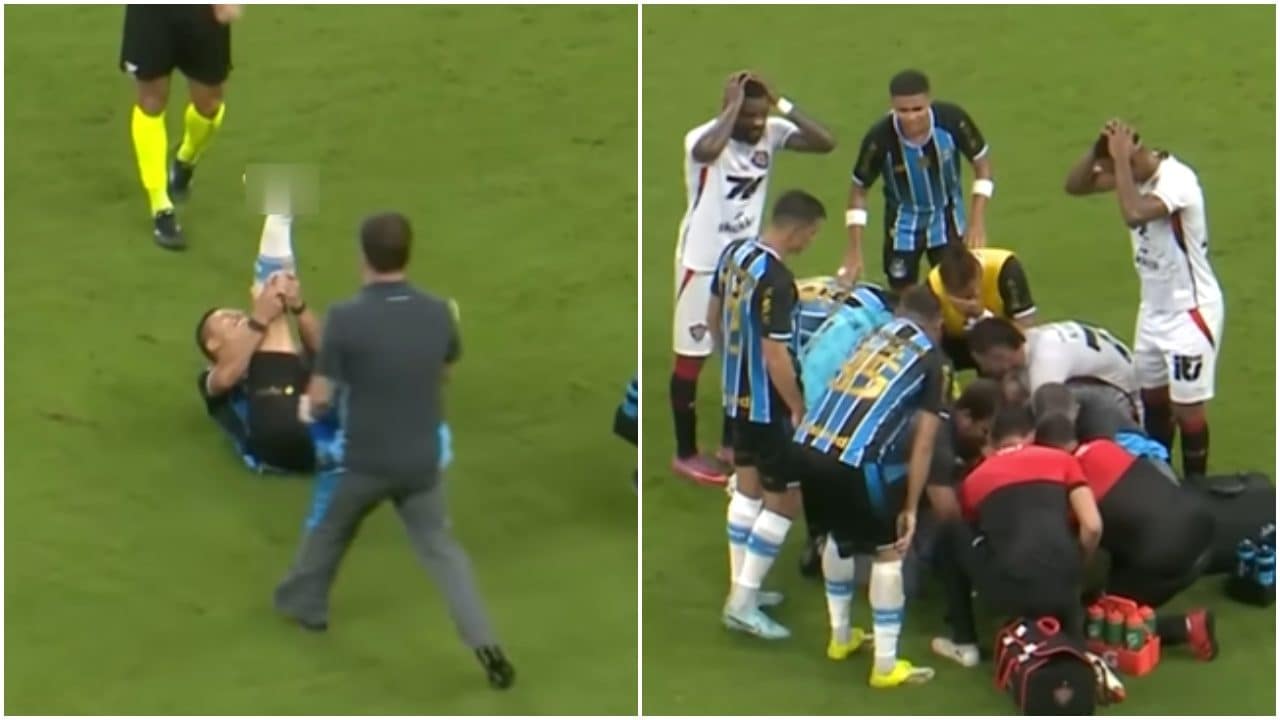 Marlon Xavier si ritrova con un piede girato al contrario in campo: avversari e arbitro attoniti