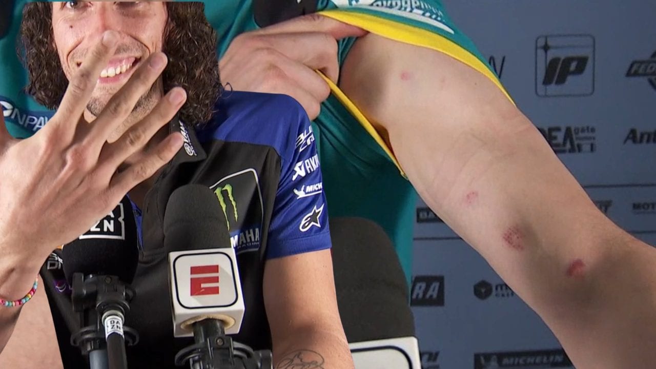 I piloti MotoGP mostrano le ferite in TV dopo la pericolosa gara in Brasile: pietre come proiettili