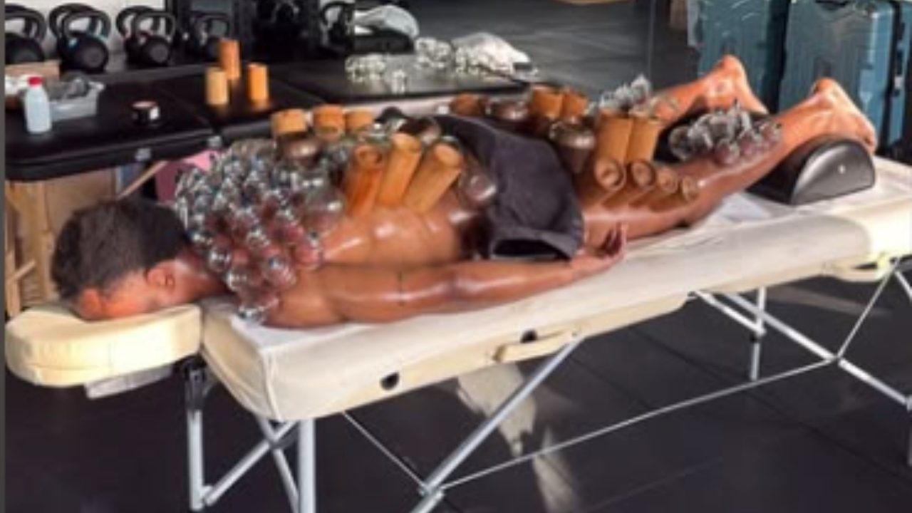 Openda si è sottoposto alla tecnica della coppettazione: perché ha il corpo ricoperto da ventose