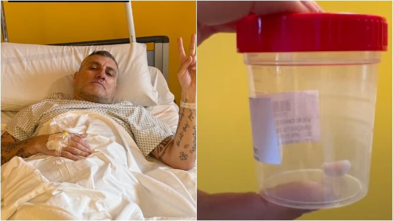 Vieri ricoverato in ospedale per un'operazione al ginocchio: mostra il frammento di osso rimosso